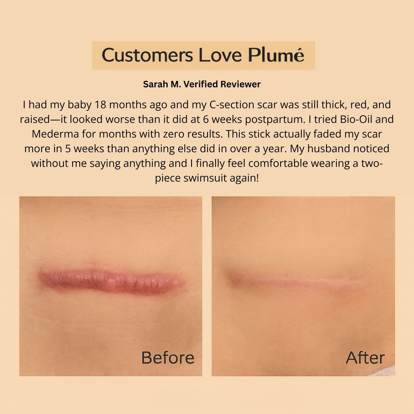 Plumé™ Medical-Grade Silicone Scar & Wrinkle Stick
