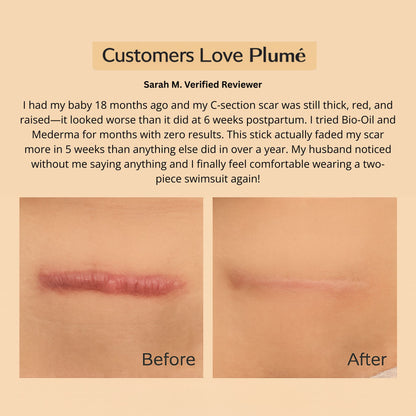 Plumé™ Medical-Grade Silicone Scar & Wrinkle Stick